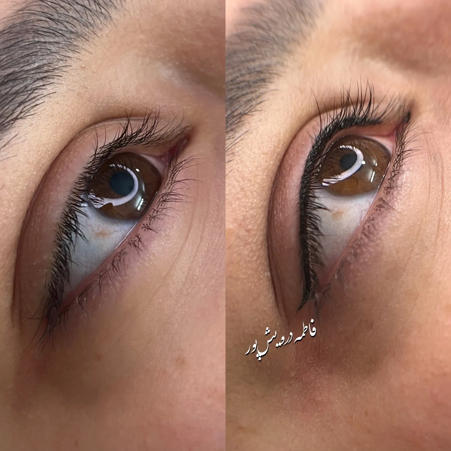 نمونه کار شیدینگ لب دائم طبیعی نمونه کار شیدینگ لب دائم طبیعی